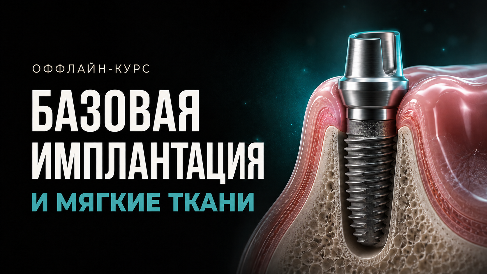 Базовая Имплантация и мягкие ткани